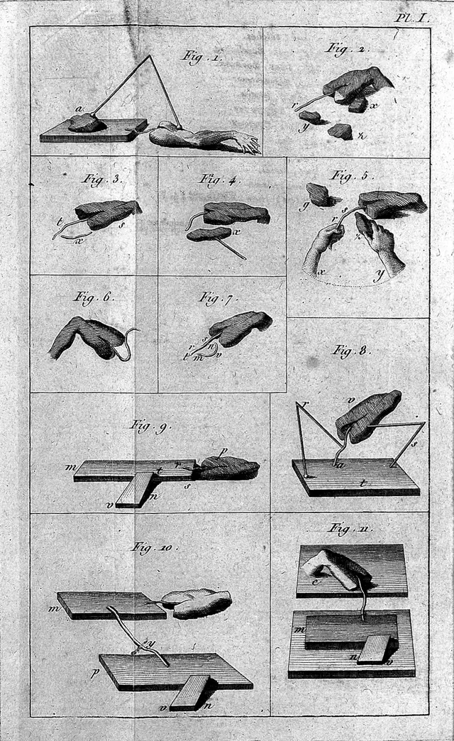Experiments on galvanism.
