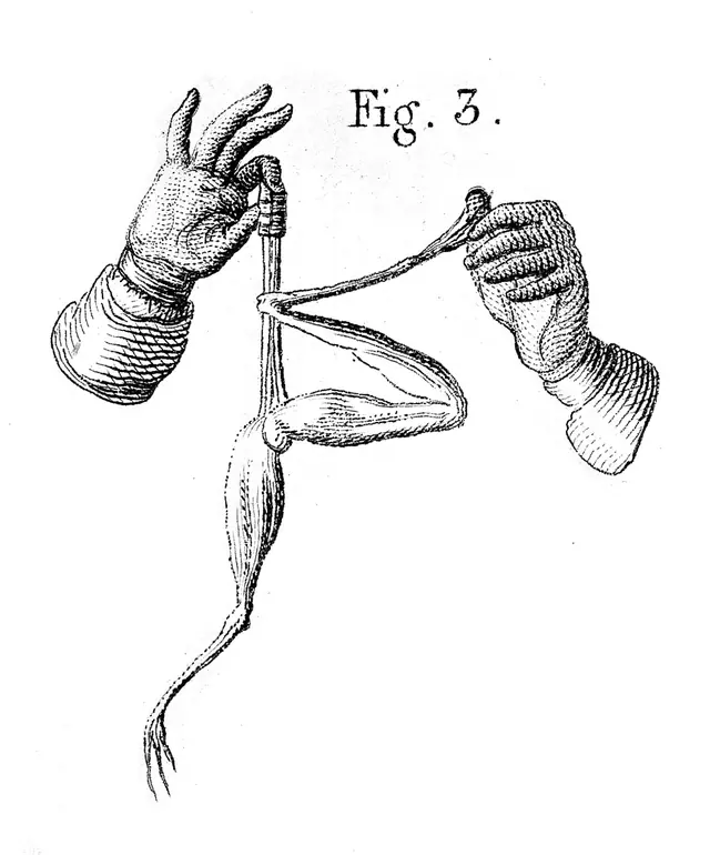 J. Aldini, galvanism
